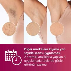 PHİLİPS BRI924/00 LUMEA IPL ADVANCED EPİLASYON